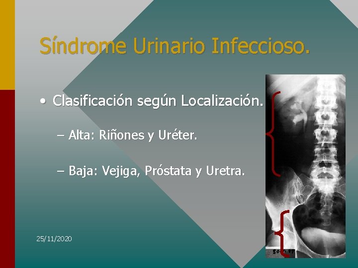 Síndrome Urinario Infeccioso. • Clasificación según Localización. – Alta: Riñones y Uréter. – Baja:
