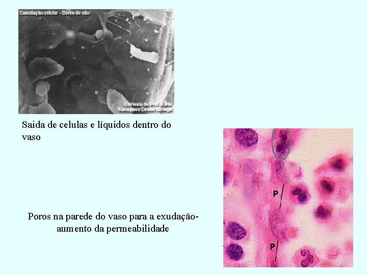 Saida de celulas e líquidos dentro do vaso Poros na parede do vaso para Saida de celulas e líquidos dentro do vaso Poros na parede do vaso para