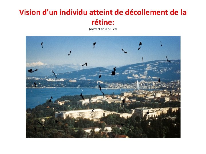 Vision d’un individu atteint de décollement de la rétine: (www. cliniqueoeil. ch) 