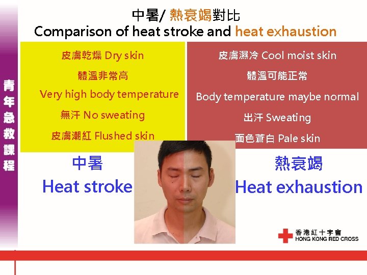 中暑/ 熱衰竭對比 Comparison of heat stroke and heat exhaustion 皮膚乾燥 Dry skin 皮膚濕冷 Cool 中暑/ 熱衰竭對比 Comparison of heat stroke and heat exhaustion 皮膚乾燥 Dry skin 皮膚濕冷 Cool