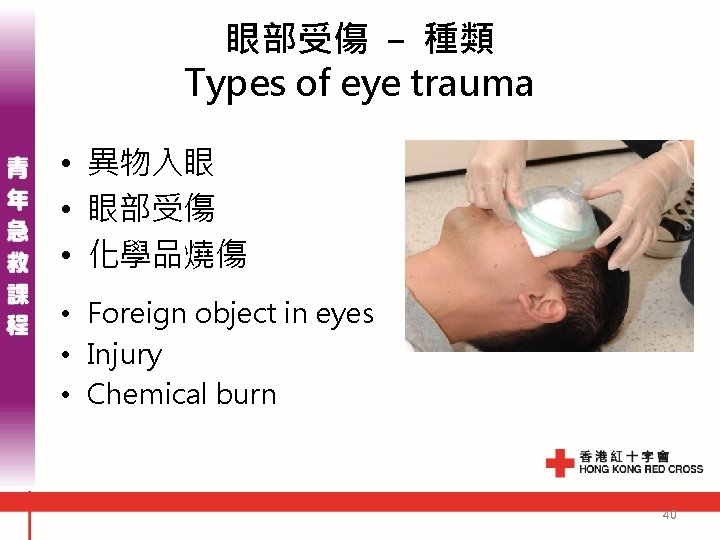 眼部受傷 - 種類 Types of eye trauma • 異物入眼 • 眼部受傷 • 化學品燒傷 • 眼部受傷 - 種類 Types of eye trauma • 異物入眼 • 眼部受傷 • 化學品燒傷 •