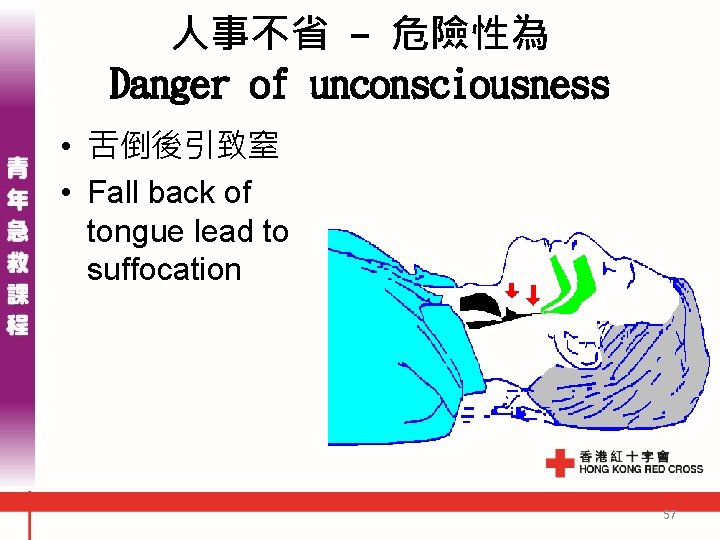 人事不省 - 危險性為 Danger of unconsciousness • 舌倒後引致窒 • Fall back of tongue lead 人事不省 - 危險性為 Danger of unconsciousness • 舌倒後引致窒 • Fall back of tongue lead