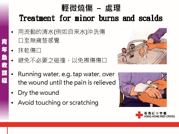 輕微燒傷 - 處理 Treatment for minor burns and scalds • 用流動的清水(例如自來水)沖洗傷 口至無痛楚感覺 • 抹乾傷口 輕微燒傷 - 處理 Treatment for minor burns and scalds • 用流動的清水(例如自來水)沖洗傷 口至無痛楚感覺 • 抹乾傷口