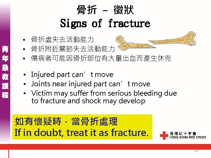 骨折 - 徵狀 Signs of fracture • 骨折處失去活動能力 • 骨折附近關節失去活動能力 • 傷病者可能因骨折部位有大量出血而產生休克 • Injured