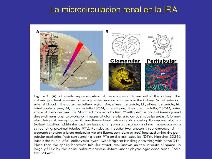 La microcirculacion renal en la IRA 