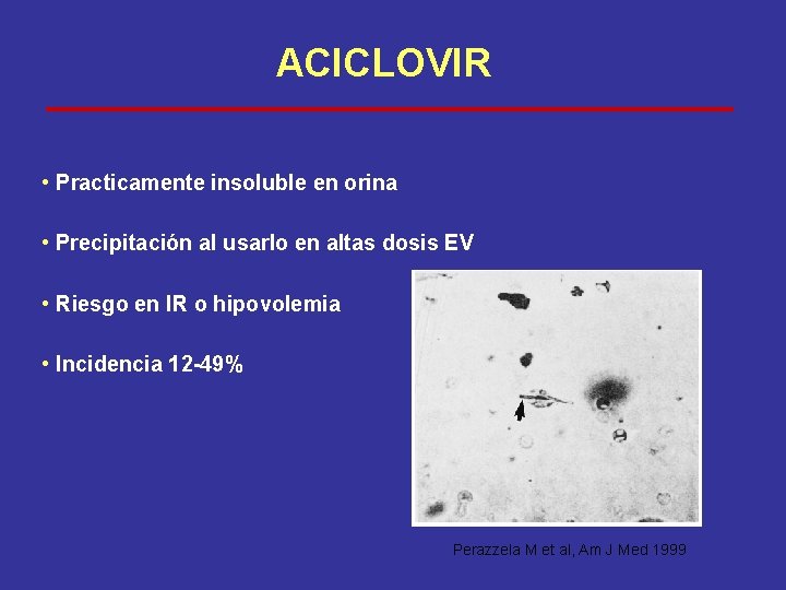 ACICLOVIR • Practicamente insoluble en orina • Precipitación al usarlo en altas dosis EV