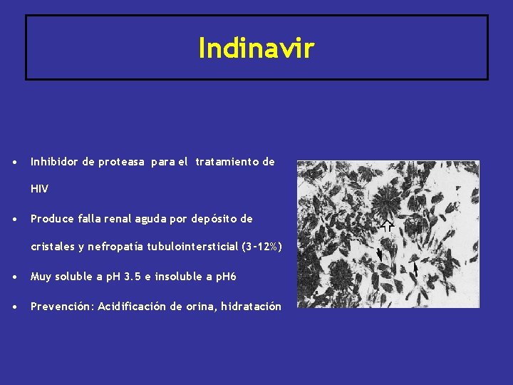 Indinavir • Inhibidor de proteasa para el tratamiento de HIV • Produce falla renal