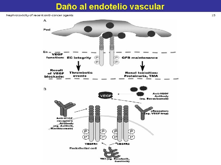 Daño al endotelio vascular 