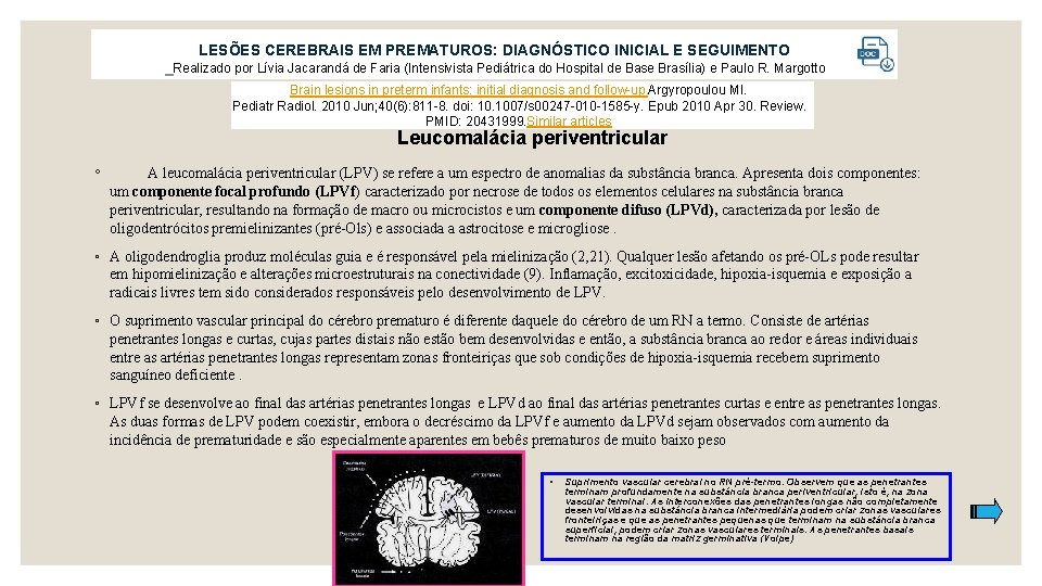 LESÕES CEREBRAIS EM PREMATUROS: DIAGNÓSTICO INICIAL E SEGUIMENTO Realizado por Lívia Jacarandá de Faria