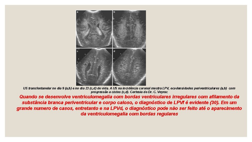 US transfontanelar no dia 9 (a, b) e no dia 23 (c, d) de
