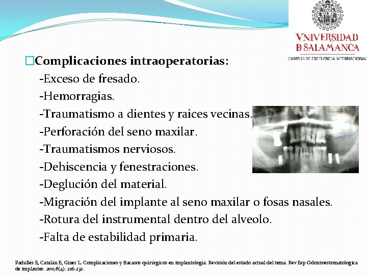 �Complicaciones intraoperatorias: -Exceso de fresado. -Hemorragias. -Traumatismo a dientes y raices vecinas. -Perforación del