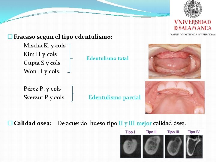 � Fracaso según el tipo edentulismo: Mischa K. y cols Kim H y cols