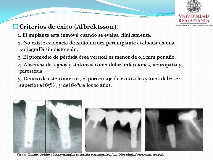 �Criterios de éxito (Albrektsson): 1. El implante esta inmóvil cuando se evalúa clínicamente. 2.