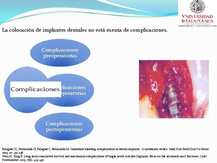 La colocación de implantes dentales no está exenta de complicaciones. Complicaciones preoperatorias Complicaciones intraoperatorias