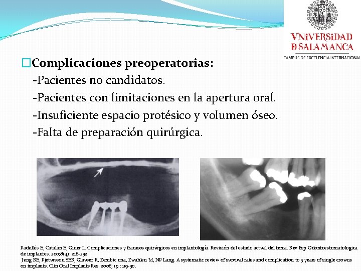 �Complicaciones preoperatorias: -Pacientes no candidatos. -Pacientes con limitaciones en la apertura oral. -Insuficiente espacio