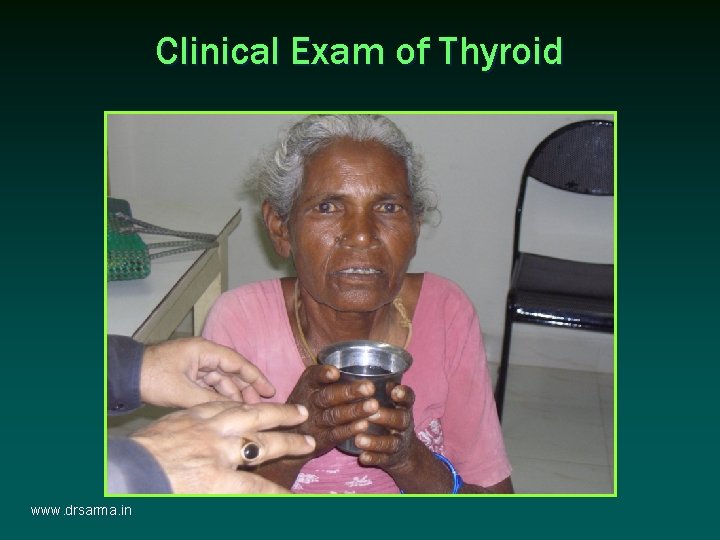 Clinical Exam of Thyroid www. drsarma. in Clinical Exam of Thyroid www. drsarma. in
