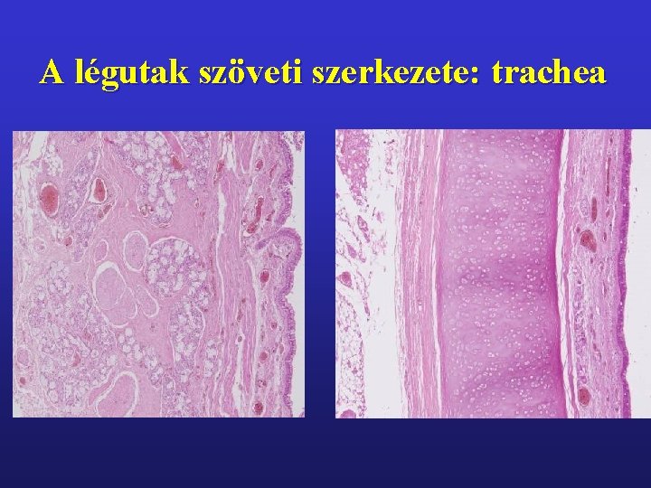 A légutak szöveti szerkezete: trachea 