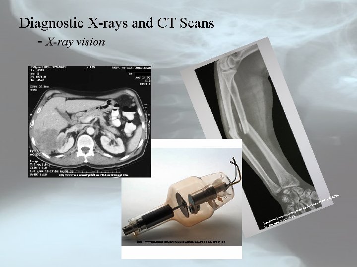 Diagnostic X-rays and CT Scans - X-ray vision http: //www. uab. edu/surgonc/cases/GI/case 2/ctscanof. htm