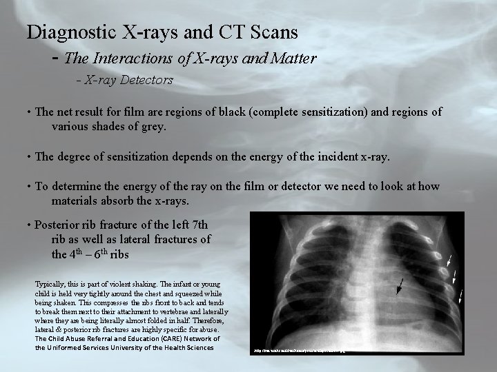 Diagnostic X-rays and CT Scans - The Interactions of X-rays and Matter - X-ray