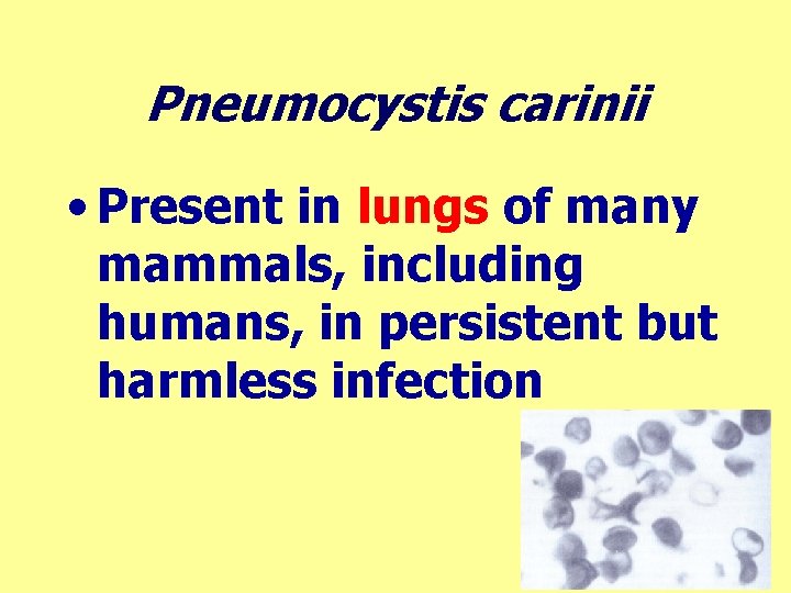 Pneumocystis carinii • Present in lungs of many mammals, including humans, in persistent but