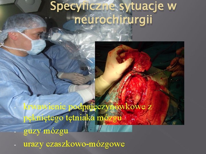 Specyficzne sytuacje w neurochirurgii - - krwawienie podpajęczynówkowe z pękniętego tętniaka mózgu guzy mózgu