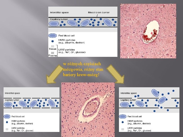 w różnych częściach mózgowia, różny stan bariery krew-mózg! 