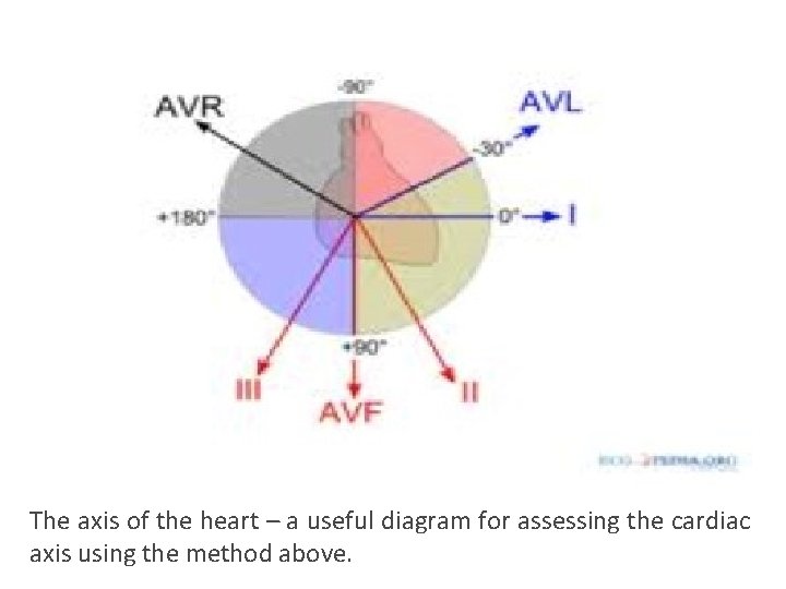 The axis of the heart – a useful diagram for assessing the cardiac axis The axis of the heart – a useful diagram for assessing the cardiac axis