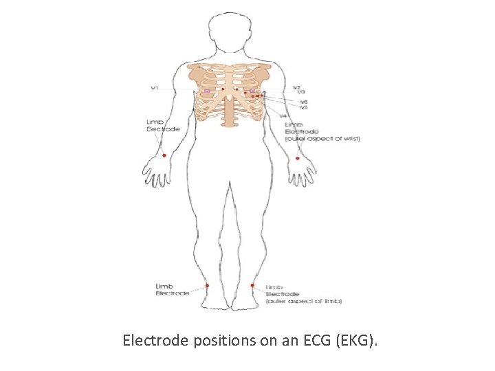 Electrode positions on an ECG (EKG). Electrode positions on an ECG (EKG).