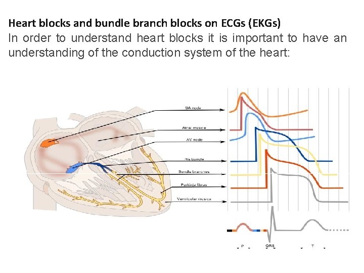 Heart blocks and bundle branch blocks on ECGs (EKGs) In order to understand heart Heart blocks and bundle branch blocks on ECGs (EKGs) In order to understand heart