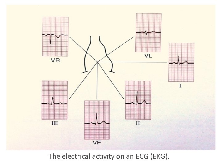 The electrical activity on an ECG (EKG). The electrical activity on an ECG (EKG).