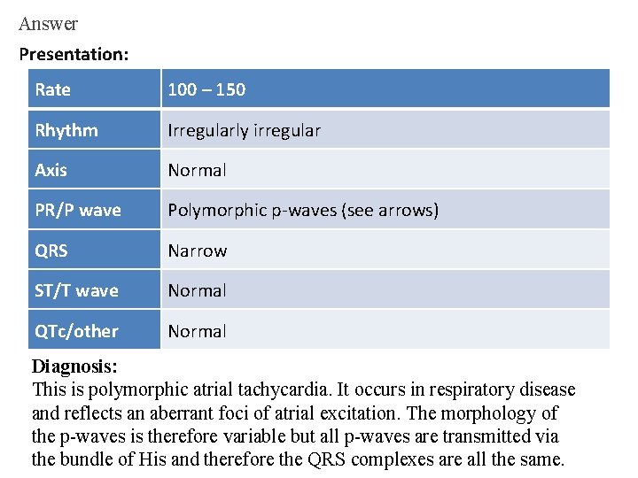 Answer Presentation: Rate 100 – 150 Rhythm Irregularly irregular Axis Normal PR/P wave Polymorphic Answer Presentation: Rate 100 – 150 Rhythm Irregularly irregular Axis Normal PR/P wave Polymorphic