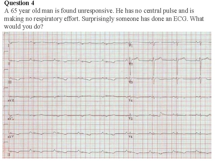 Question 4 A 65 year old man is found unresponsive. He has no central Question 4 A 65 year old man is found unresponsive. He has no central