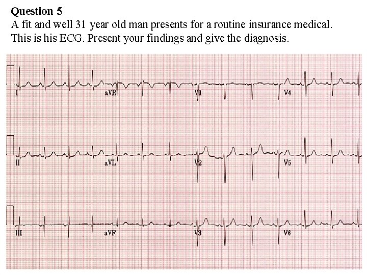 Question 5 A fit and well 31 year old man presents for a routine Question 5 A fit and well 31 year old man presents for a routine