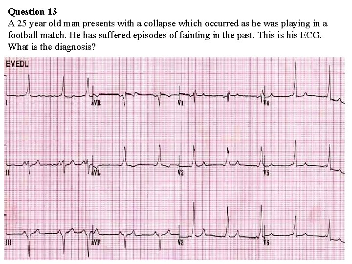 Question 13 A 25 year old man presents with a collapse which occurred as Question 13 A 25 year old man presents with a collapse which occurred as