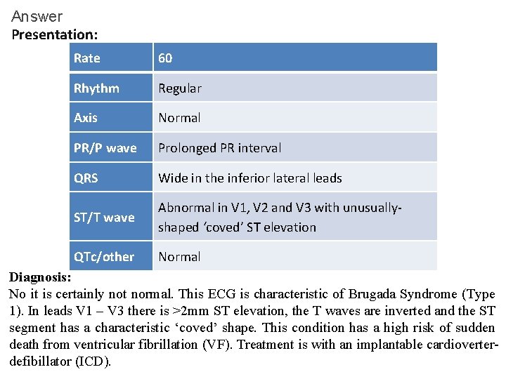 Answer Presentation: Rate 60 Rhythm Regular Axis Normal PR/P wave Prolonged PR interval QRS Answer Presentation: Rate 60 Rhythm Regular Axis Normal PR/P wave Prolonged PR interval QRS