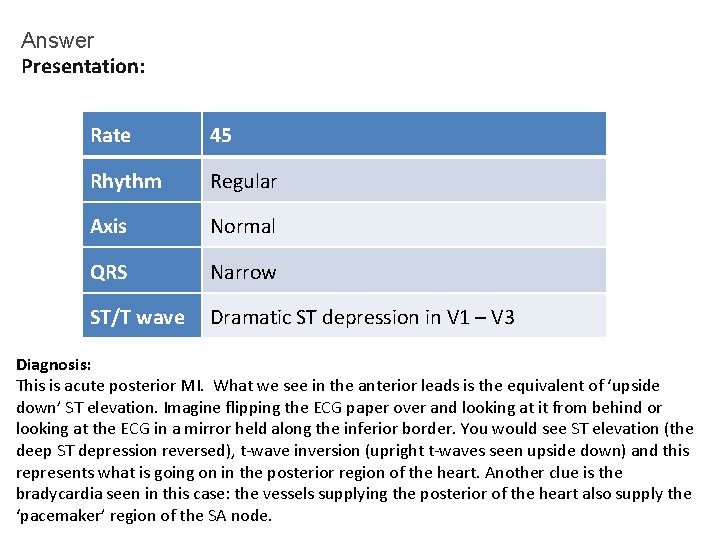 Answer Presentation: Rate 45 Rhythm Regular Axis Normal QRS Narrow ST/T wave Dramatic ST Answer Presentation: Rate 45 Rhythm Regular Axis Normal QRS Narrow ST/T wave Dramatic ST