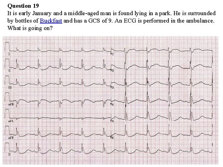 Question 19 It is early January and a middle-aged man is found lying in Question 19 It is early January and a middle-aged man is found lying in