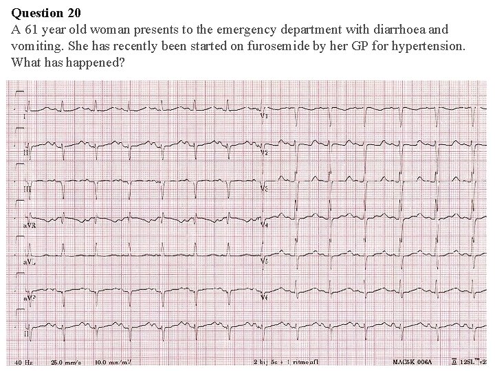 Question 20 A 61 year old woman presents to the emergency department with diarrhoea Question 20 A 61 year old woman presents to the emergency department with diarrhoea