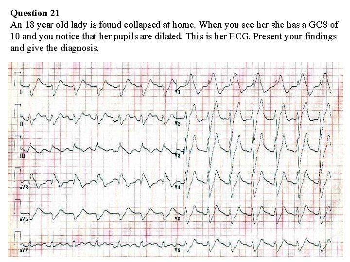 Question 21 An 18 year old lady is found collapsed at home. When you Question 21 An 18 year old lady is found collapsed at home. When you
