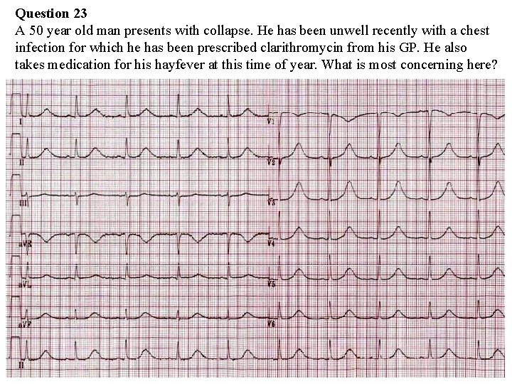 Question 23 A 50 year old man presents with collapse. He has been unwell Question 23 A 50 year old man presents with collapse. He has been unwell