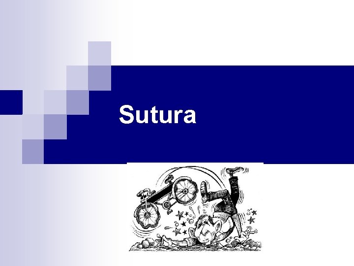 Sutura 