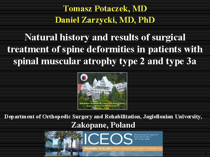 Tomasz Potaczek, MD Daniel Zarzycki, MD, Ph. D Natural history and results of surgical Tomasz Potaczek, MD Daniel Zarzycki, MD, Ph. D Natural history and results of surgical