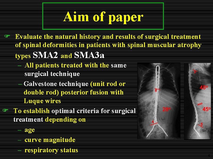 Aim of paper F Evaluate the natural history and results of surgical treatment of Aim of paper F Evaluate the natural history and results of surgical treatment of