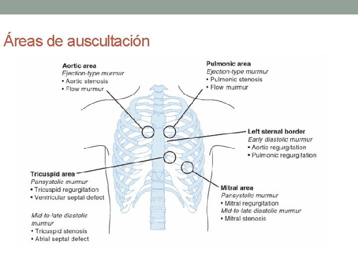 Áreas de auscultación Áreas de auscultación