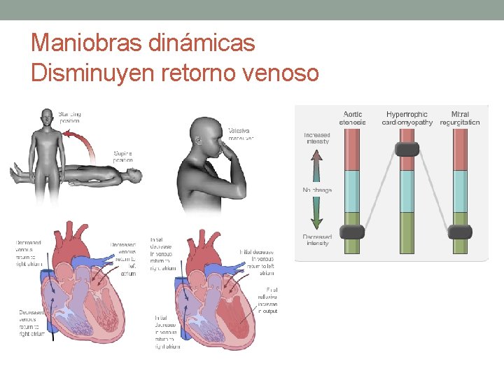 Maniobras dinámicas Disminuyen retorno venoso Maniobras dinámicas Disminuyen retorno venoso