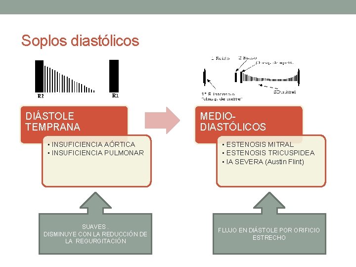 Soplos diastólicos DIÁSTOLE TEMPRANA • INSUFICIENCIA AÓRTICA • INSUFICIENCIA PULMONAR SUAVES. DISMINUYE CON LA Soplos diastólicos DIÁSTOLE TEMPRANA • INSUFICIENCIA AÓRTICA • INSUFICIENCIA PULMONAR SUAVES. DISMINUYE CON LA