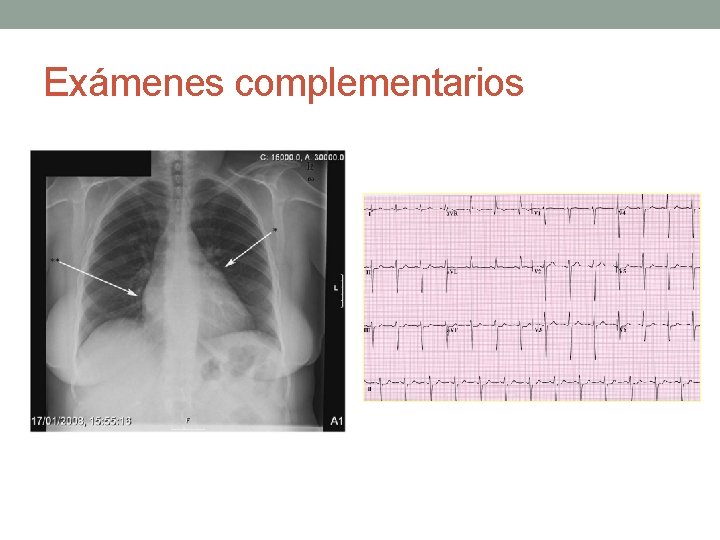 Exámenes complementarios Exámenes complementarios