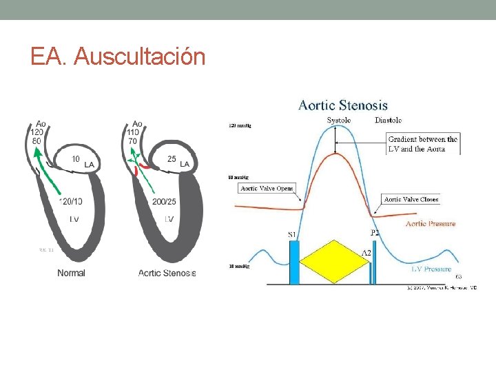 EA. Auscultación EA. Auscultación