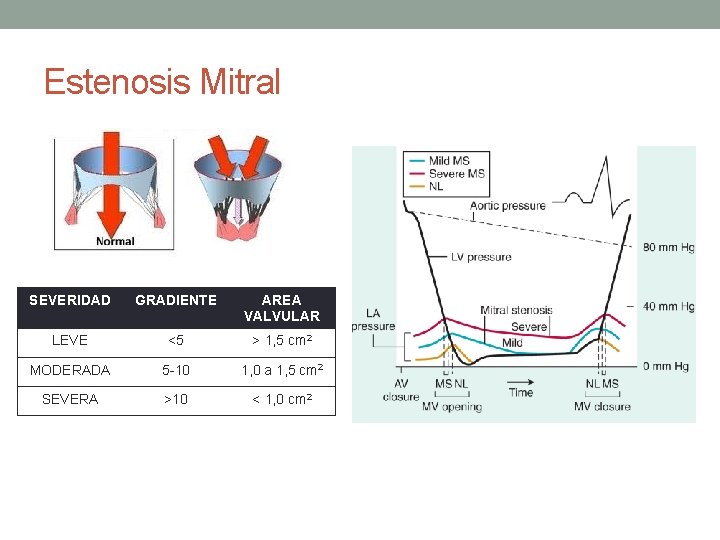 Estenosis Mitral SEVERIDAD GRADIENTE AREA VALVULAR LEVE <5 > 1, 5 cm 2 MODERADA Estenosis Mitral SEVERIDAD GRADIENTE AREA VALVULAR LEVE <5 > 1, 5 cm 2 MODERADA