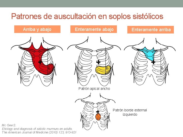 Patrones de auscultación en soplos sistólicos Arriba y abajo Enteramente arriba Patrón apical ancho Patrones de auscultación en soplos sistólicos Arriba y abajo Enteramente arriba Patrón apical ancho